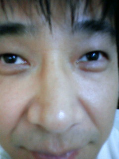 鼻炎.jpg
