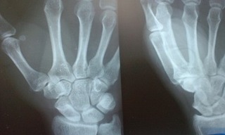 X-ray 001.jpg